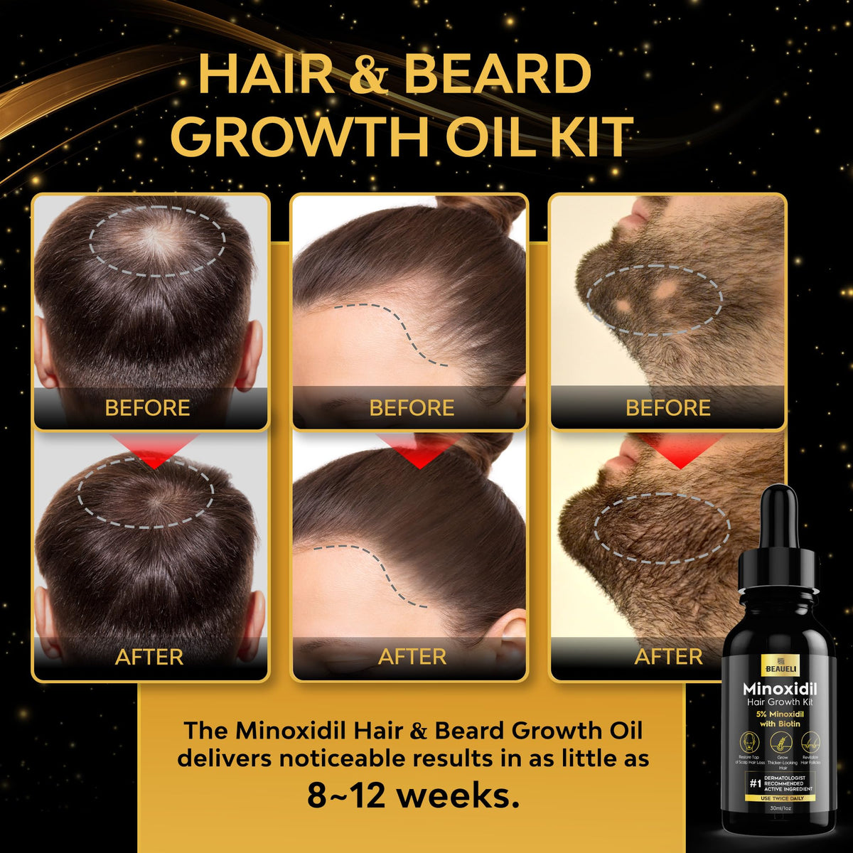 beaueli Minoxidil Beard Growth Kit serum bottle close-up
