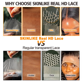 BEEOS HD Lace Closure side view highlighting natural hairline