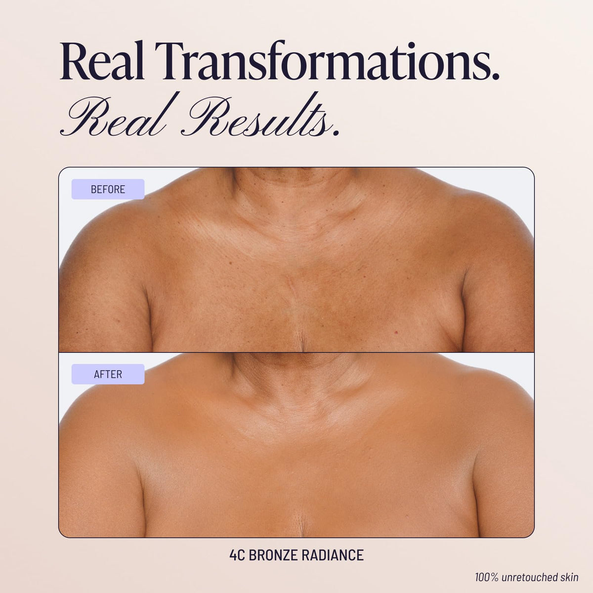 Before and after comparison using Westmore Beauty Body Coverage Perfector