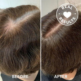 Before and after results of Madison Reed Root Perfection application