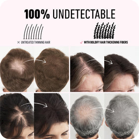 Before and after using Boldify Hair Fibers