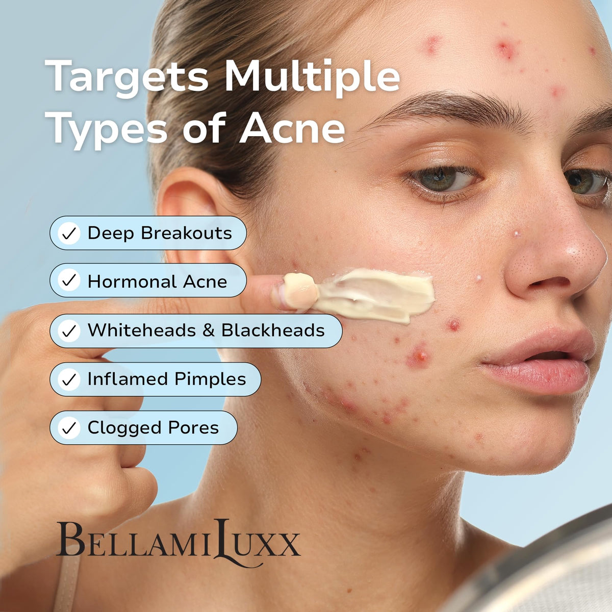 BellamiLuxx Cystic Acne Cream application on skin