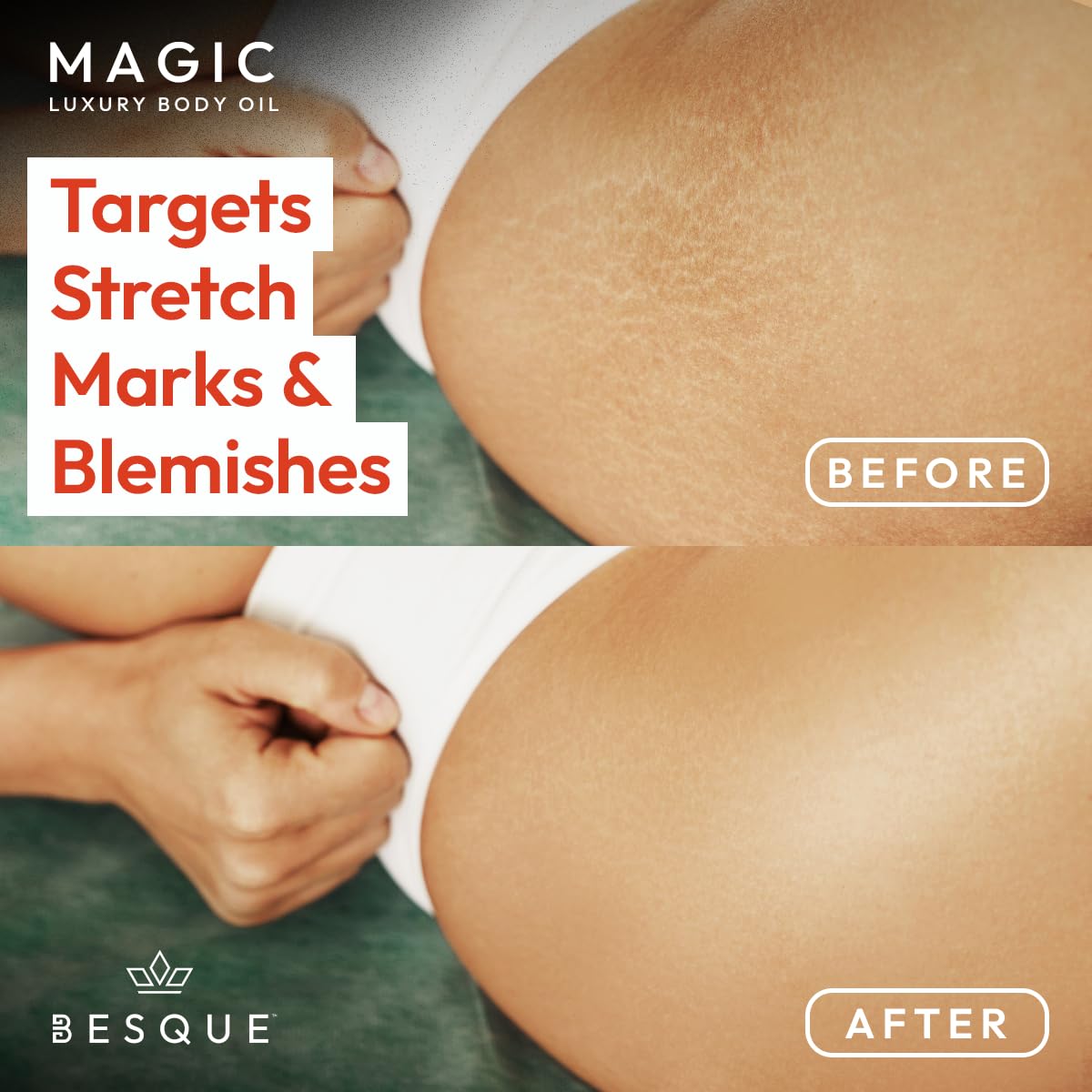 Besque Magic Body Oil 3.4 FL OZ with dropper