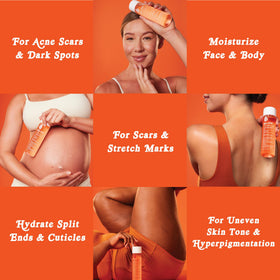 Bio-Oil Skincare Body Oil Serum 2 fl oz lifestyle scene