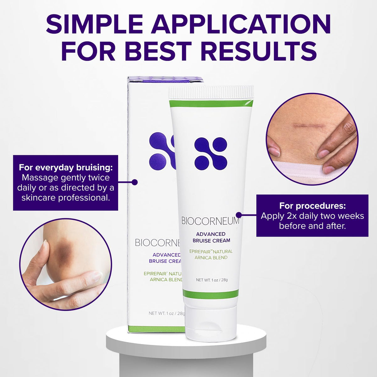 BIOCORNEUM Bruise Cream back view