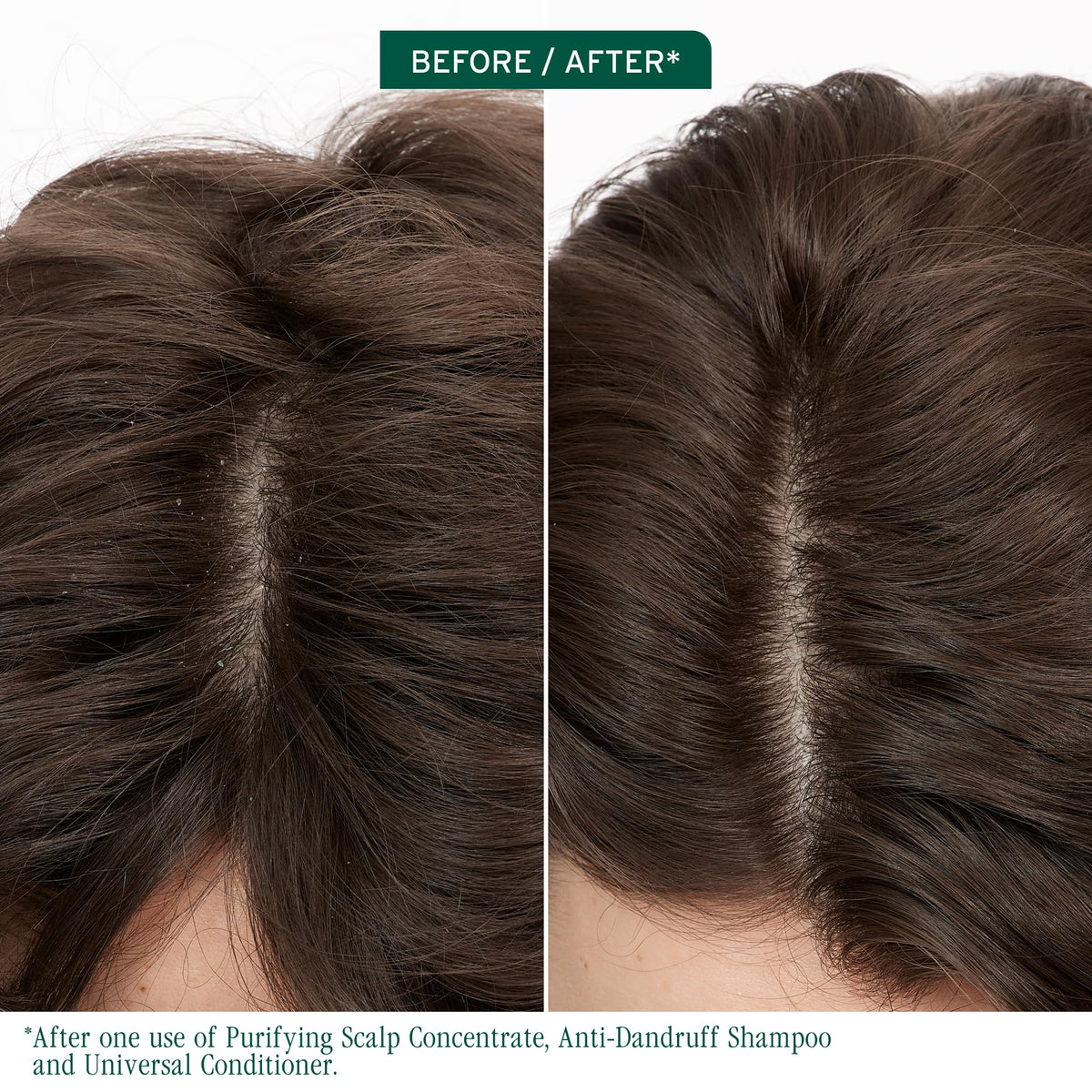 Biolage Scalp Sync Anti-Dandruff Shampoo bottle side view