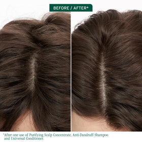 Biolage Scalp Sync Anti-Dandruff Shampoo bottle side view