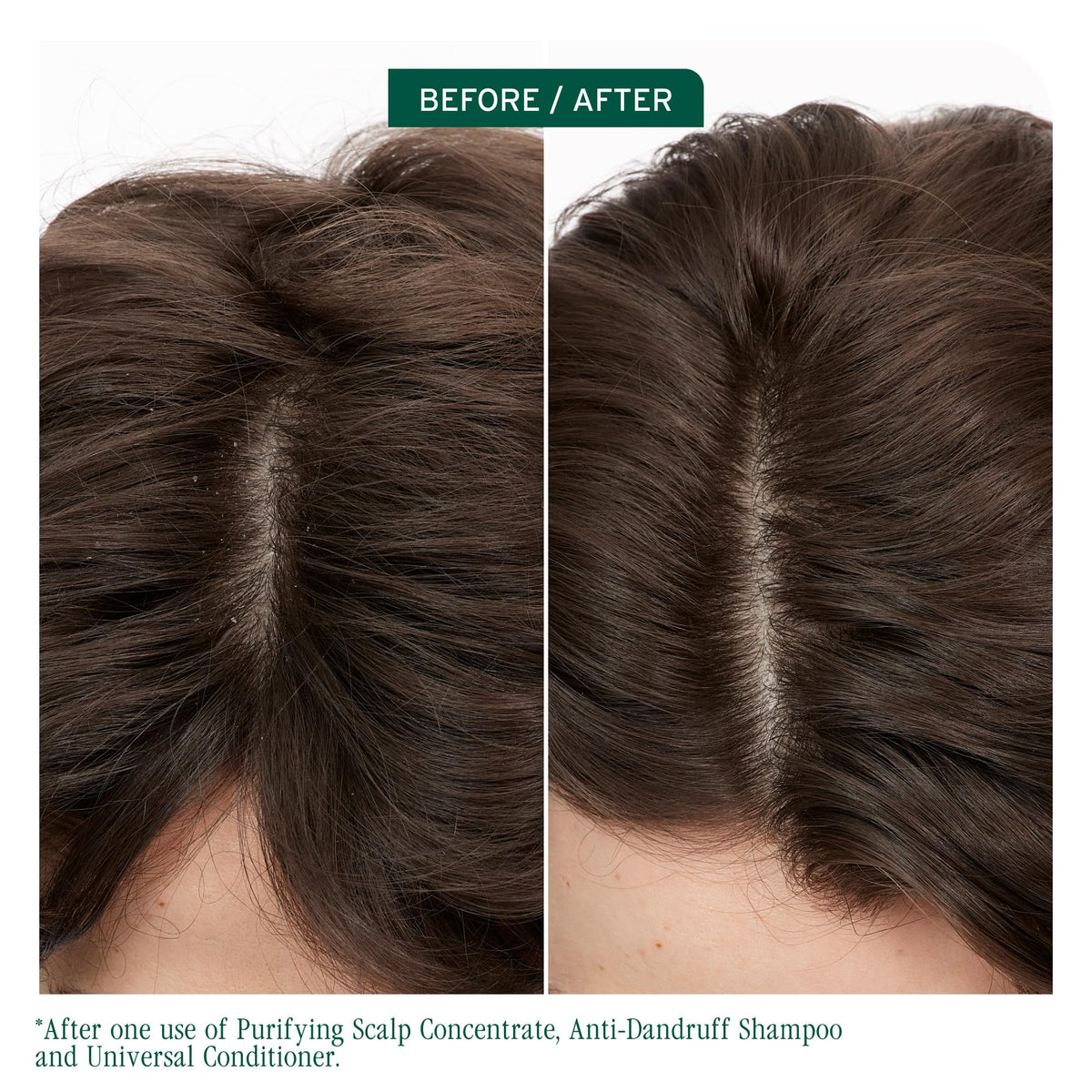 Biolage Scalp Sync Anti-Dandruff Shampoo bottle with cap