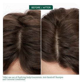 Biolage Scalp Sync Anti-Dandruff Shampoo bottle with cap