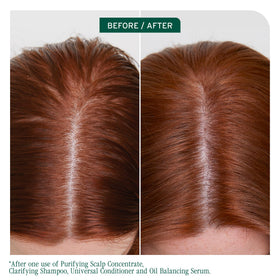 Biolage Scalp Sync Clarifying Shampoo 33.8 fl oz back view