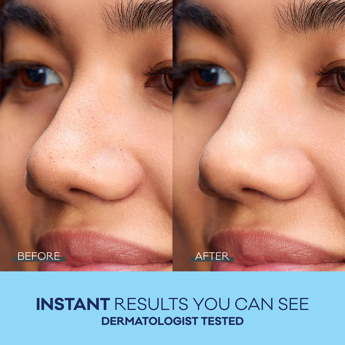 Bioré Charcoal Deep Cleansing Nose Pore Strips with blackhead removal results