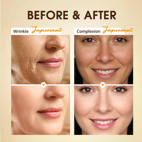 BIYSBER Retinol Collagen Serum bottle with cap