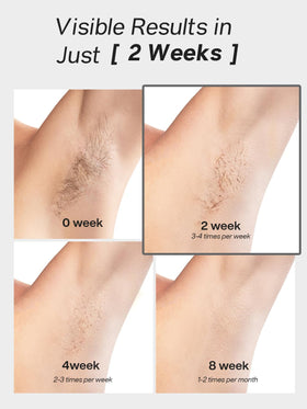 Blex Laser Hair Removal Device side view with controls