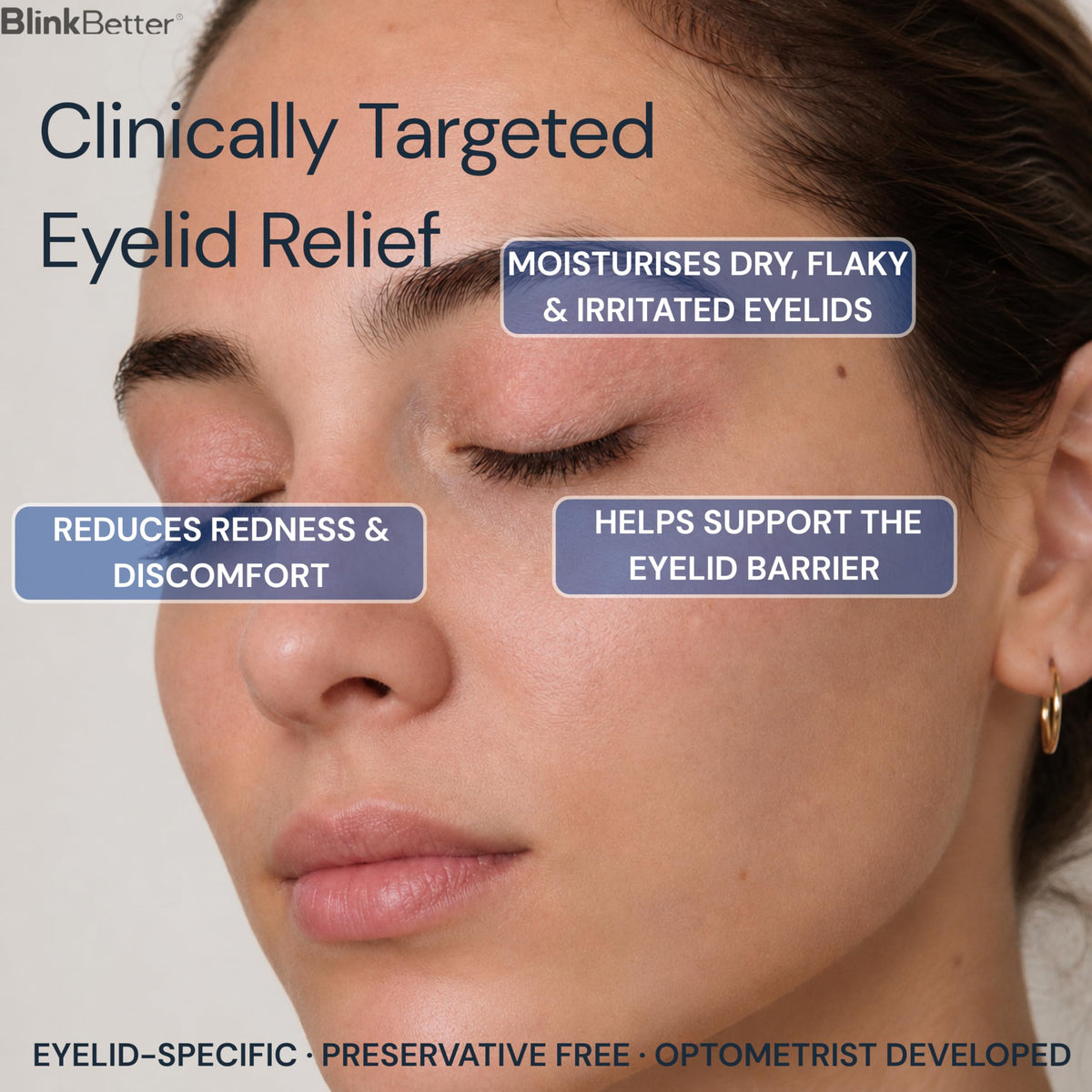 BlinkBetter Eyelid Ointment 10g packaging with ingredients