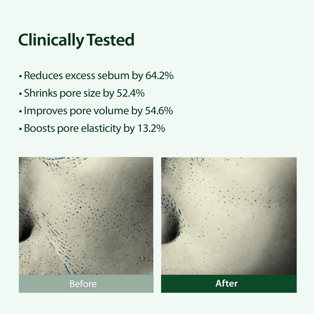 BLITHE Targeted Pore Serum application on skin