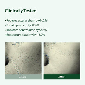 BLITHE Targeted Pore Serum application on skin