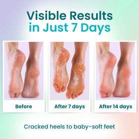 BLOOMORA Foot Peeling Mask Peach variant
