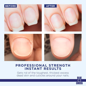 Blue Cross Cuticle Remover bottle side view