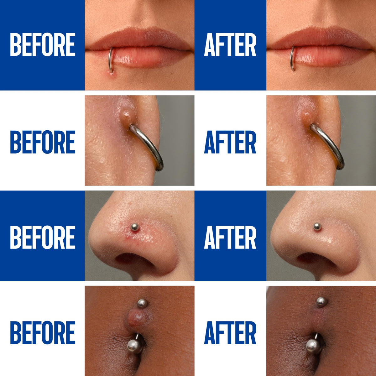 BodyJ4You Piercing Aftercare Spray packaging with protective cap