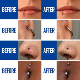 BodyJ4You Piercing Aftercare Spray packaging with protective cap