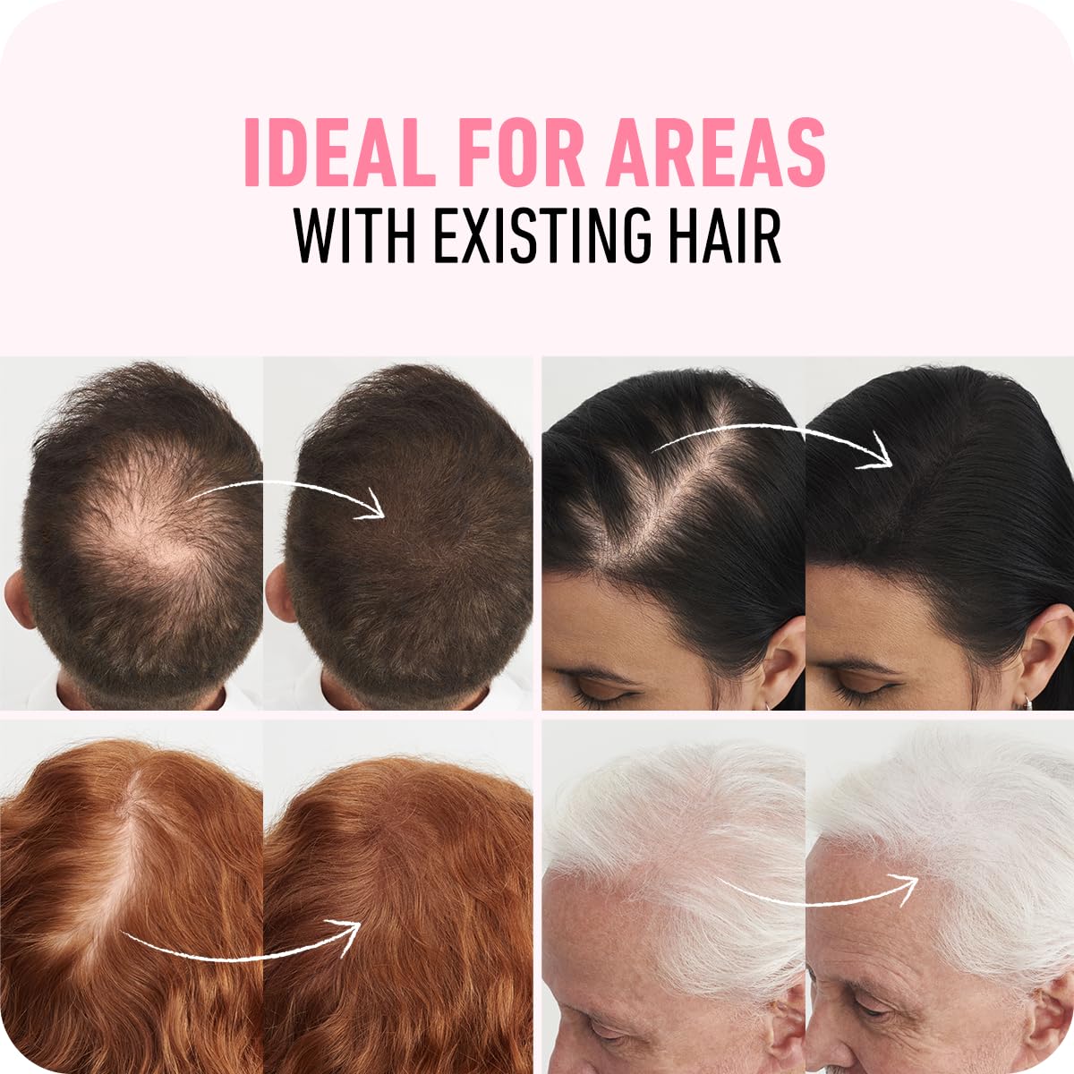 Boldify Hair Fibers Medium Blonde 56.5g application demonstration