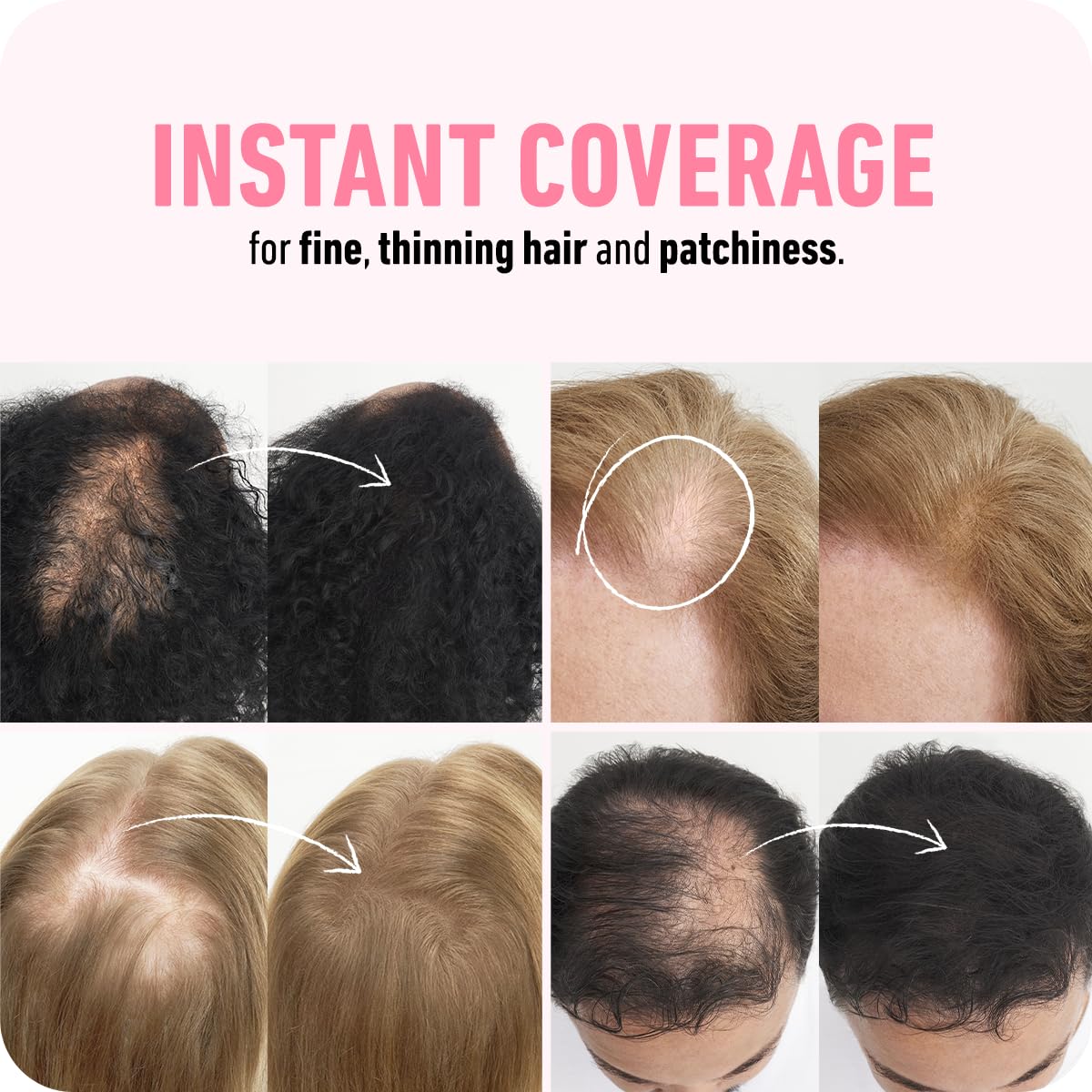 Boldify Hair Fibers Medium Brown 28g application demonstration