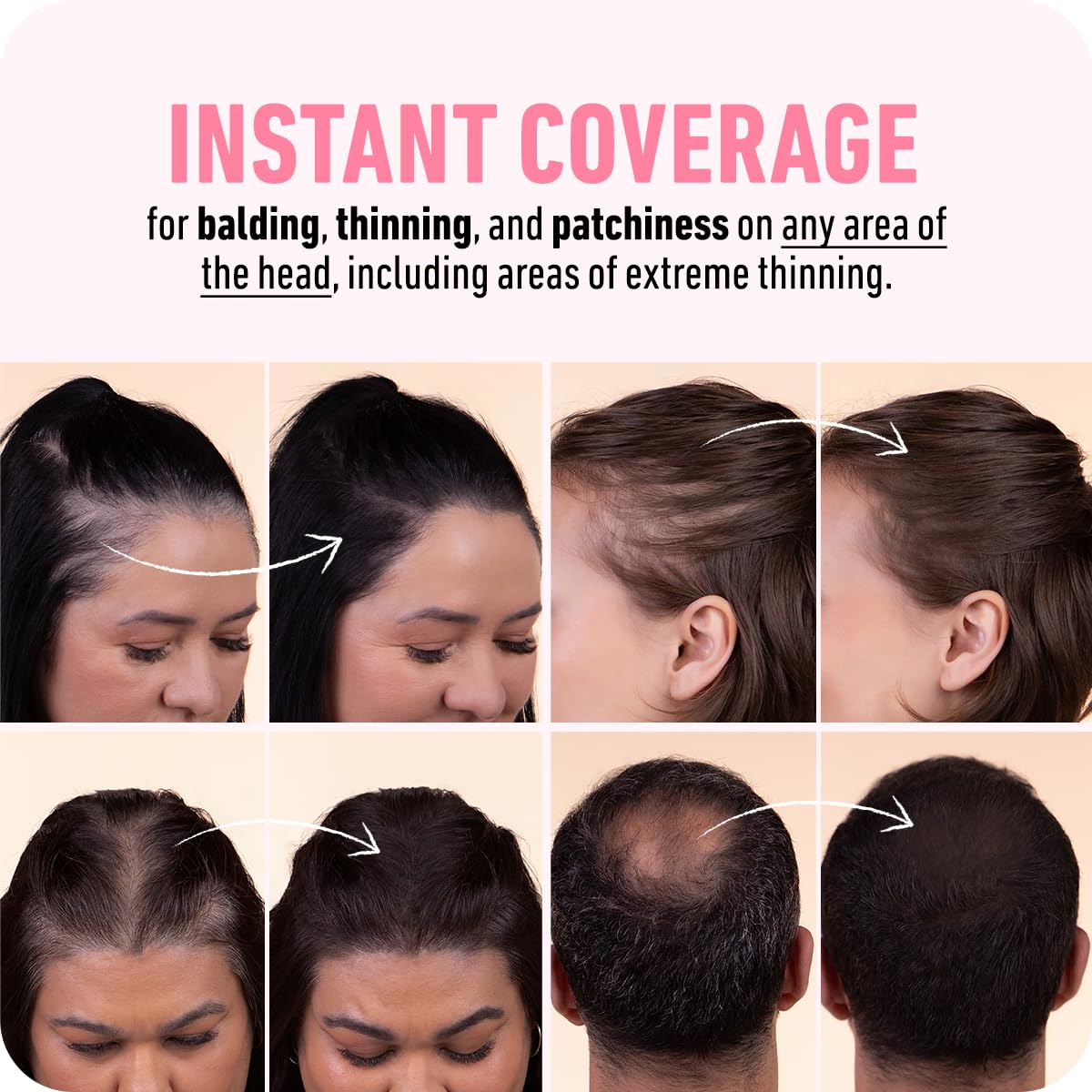 Boldify Hairline Powder Black 10g lifestyle scene