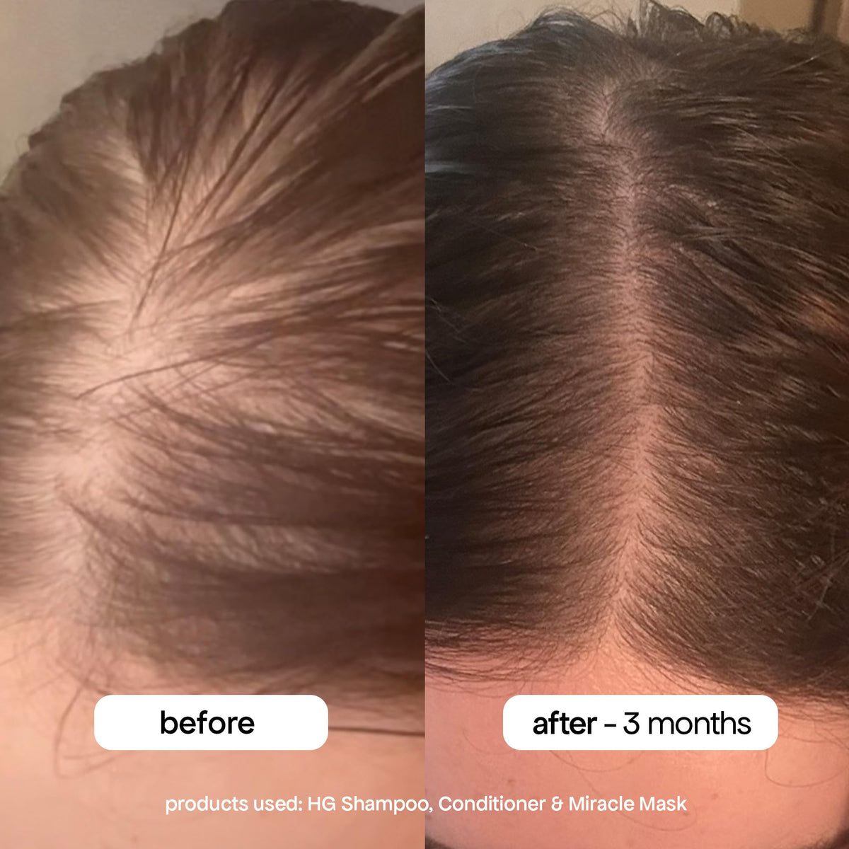 BONDIBOOST HG Anti-Thinning Conditioner front view 16.9 fl oz