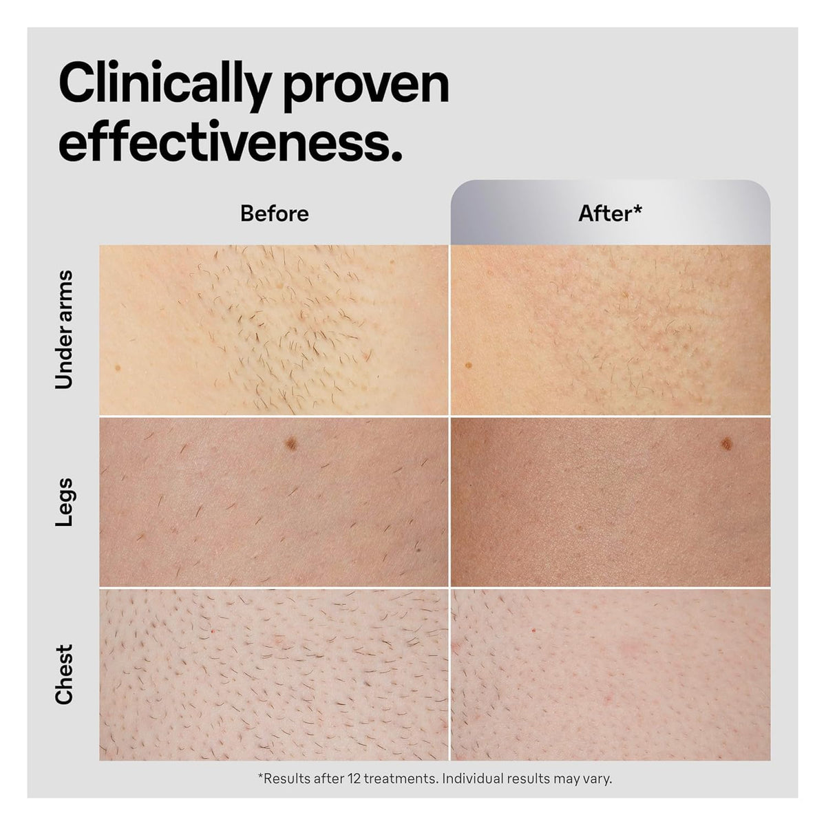 Braun Smart IPL device with user-friendly interface