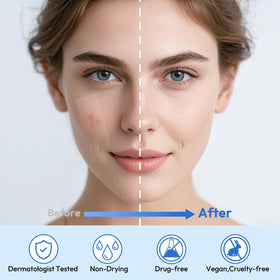 Breiboz Large Pimple Patches with product dimensions