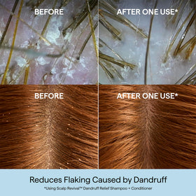 Briogeo Scalp Revival Dandruff Relief Shampoo showing ingredients list