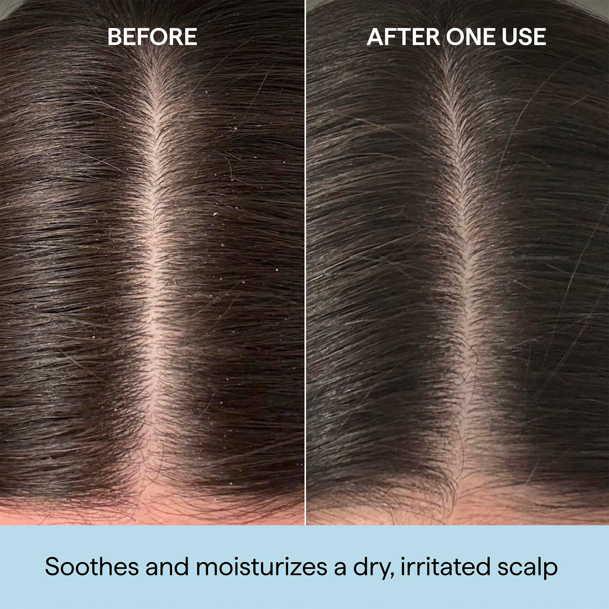Briogeo Scalp Revival Rosemary Pre-Wash Oil back view