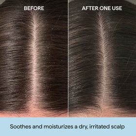 Briogeo Scalp Revival Rosemary Pre-Wash Oil back view