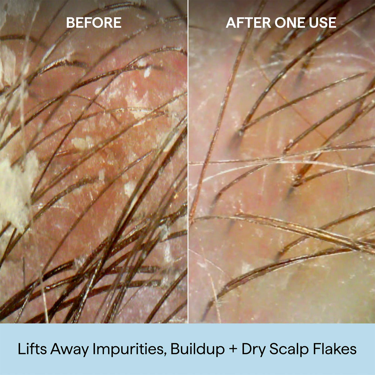 Briogeo Scalp Revival Shampoo back view with instructions