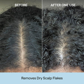 Briogeo Scalp Revival Shampoo showing texture on hand