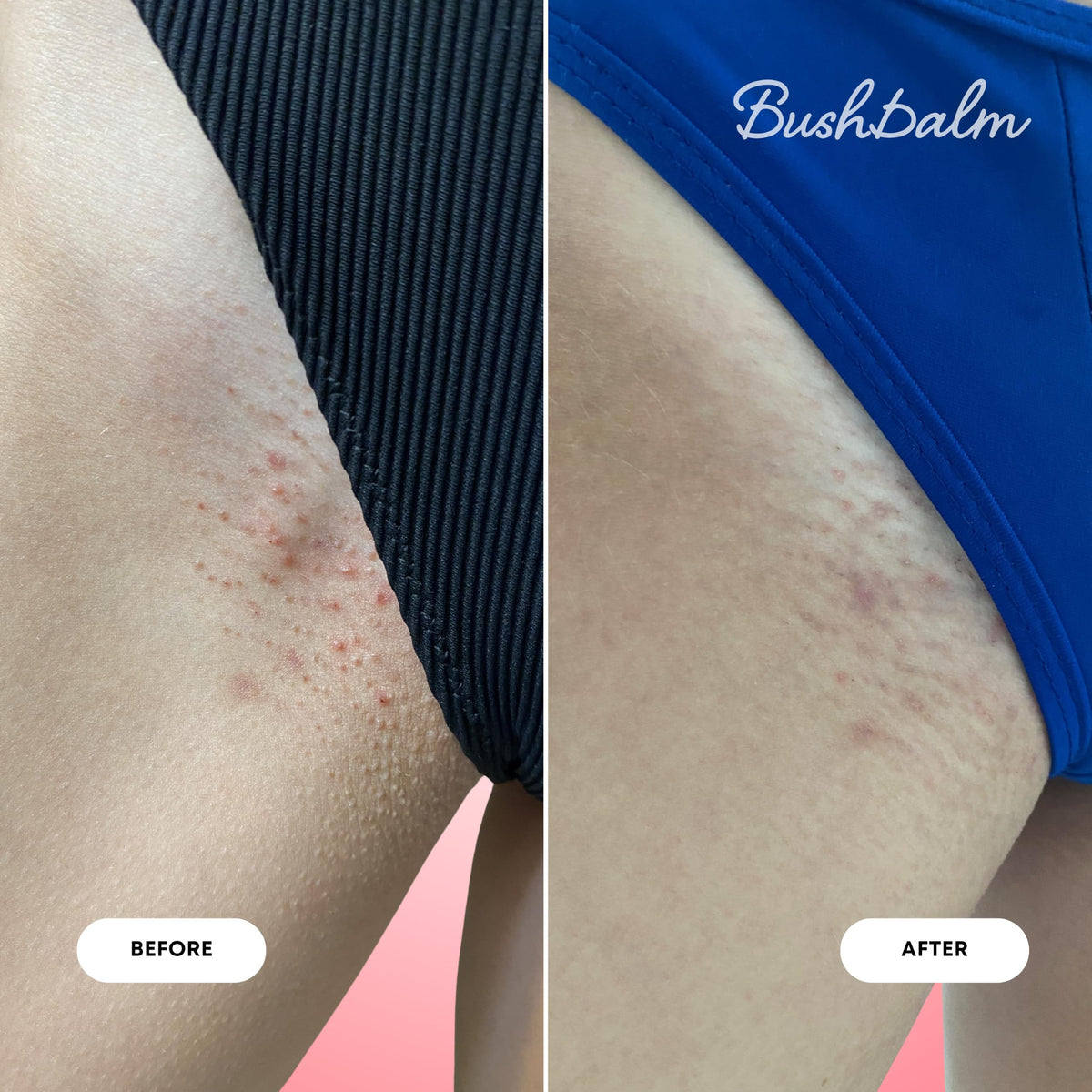 Bushbalm 2-Step Ingrown Hair Routine ingredients list