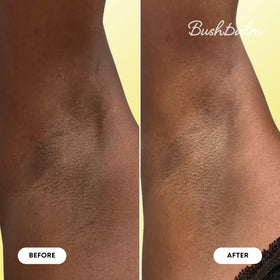Bushbalm Dark Spot Oil Bermuda 30ml ingredients list