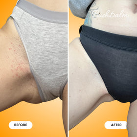 Bushbalm Ingrown Hair Exfoliating Body Scrub Vanilla Tangerine with body oils