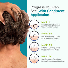 C'rcle Minoxidil Foam 5% for Men easy application process