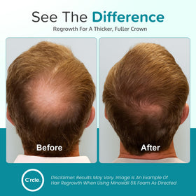 C'rcle Minoxidil Foam 5% for Men texture close-up