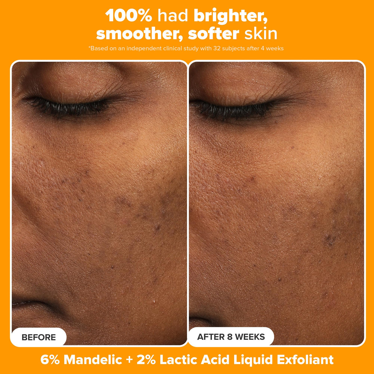 C15 Super support vitamin C serum from Paula's Choice Brighter Days Ahead Kit