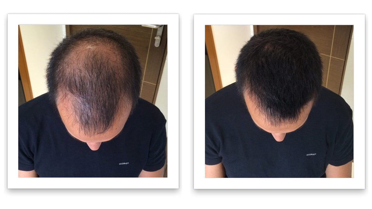 Caboki Hair Fibers 30g Black on different hair types