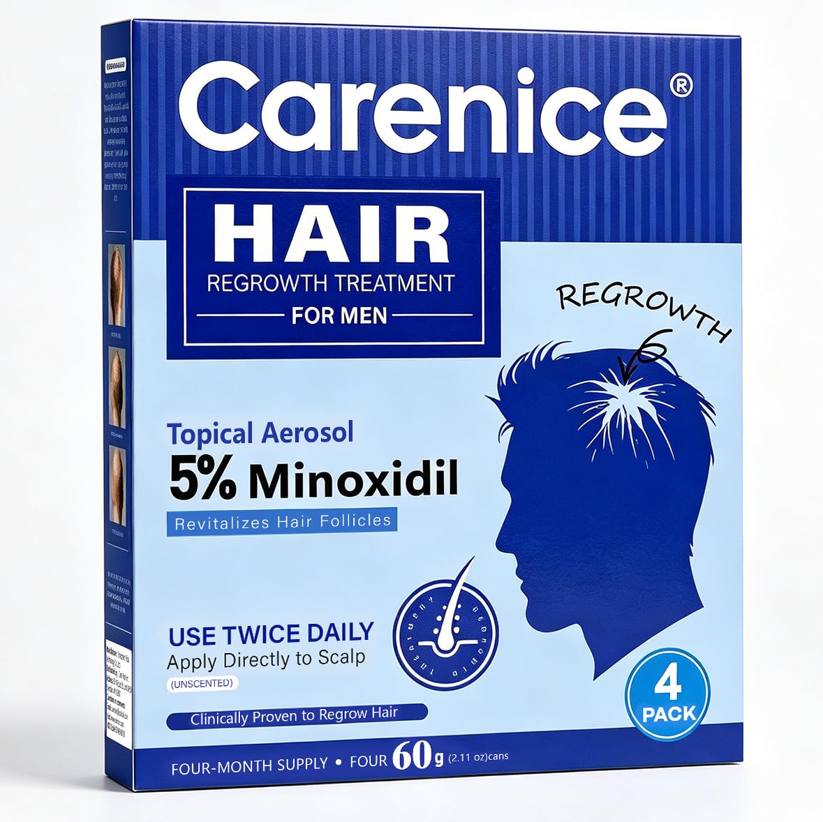 CARENICE Men's 5% Minoxidil Foam in hand for application