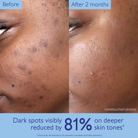 Caudalie Vinoperfect serum on a wooden surface