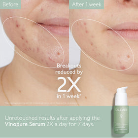 Caudalie Vinopure Serum application on skin