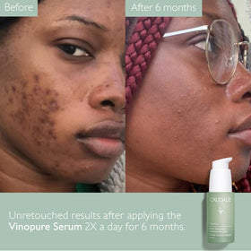 Caudalie Vinopure Serum in a skincare routine setting
