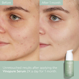 Caudalie Vinopure Serum on a clean bathroom counter