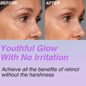 CELDYQUE Bakuchiol Serum 30,000 ppm texture close-up