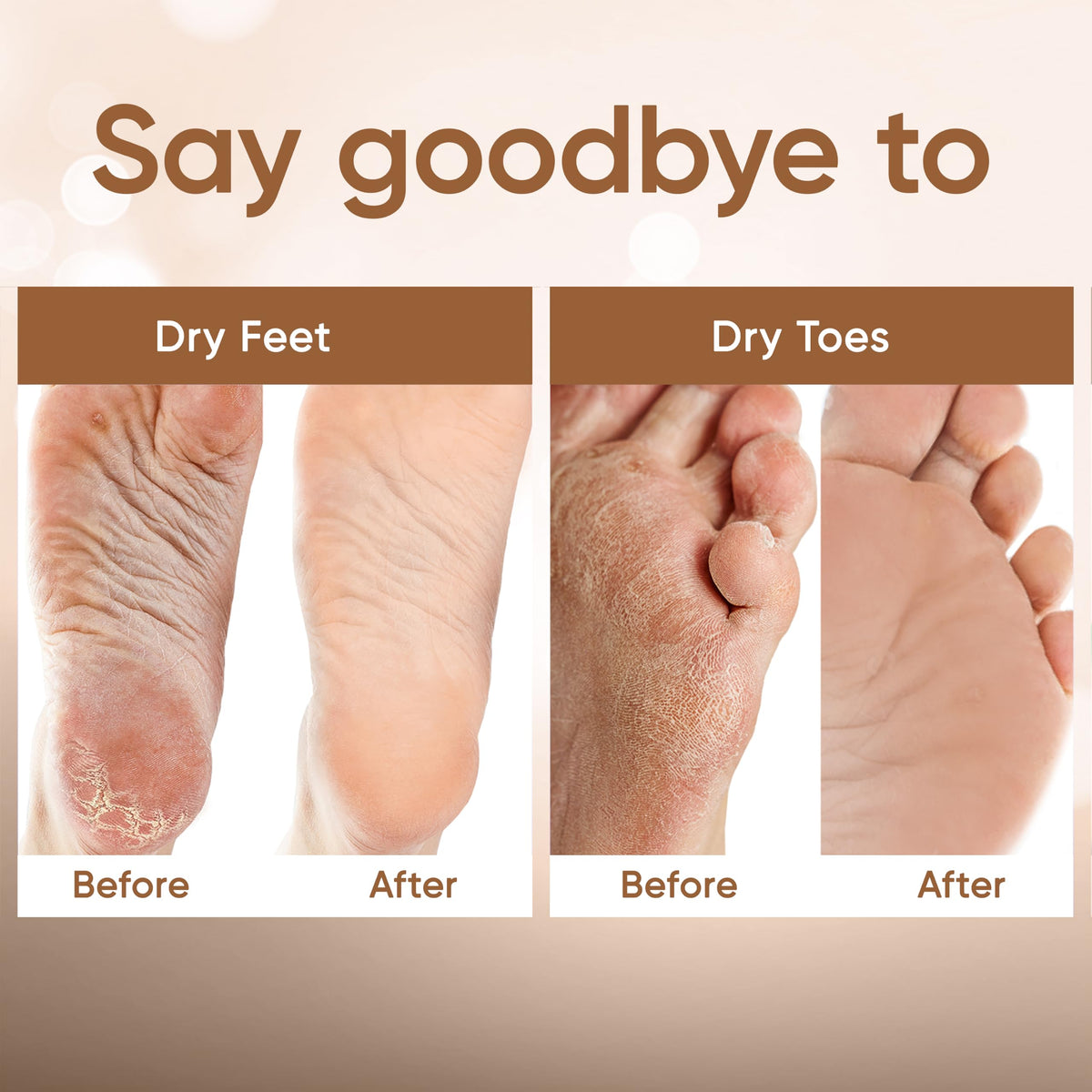 CÉLOR Foot Peel Mask booties fitting comfortably on feet