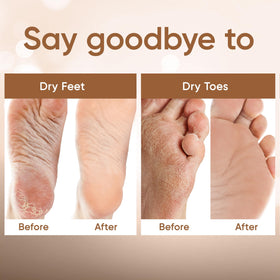 CÉLOR Foot Peel Mask booties fitting comfortably on feet